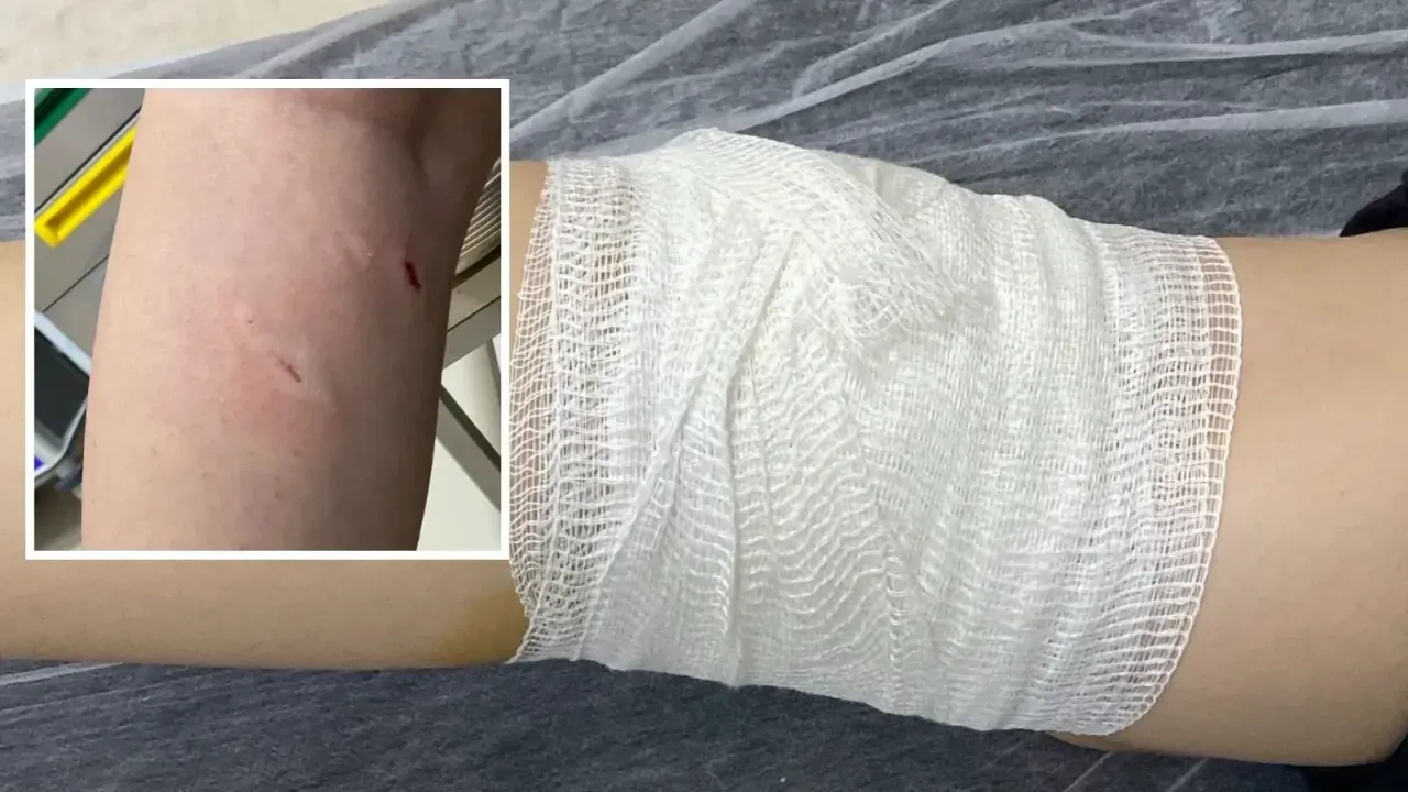Lise öğrencisine köpek saldırdı!